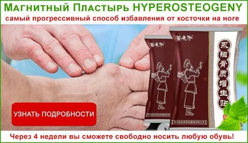 як лікувати кісточки жовчю