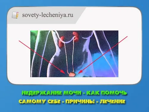 як можна вилікувати енурез у домашніх умовах