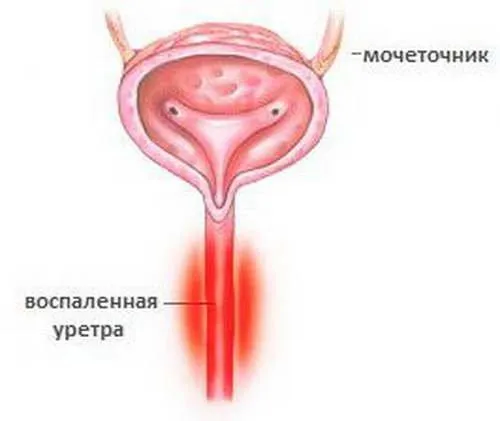 чоловіче здоров'я