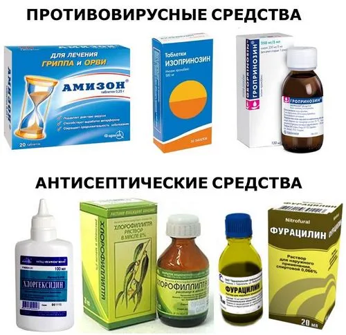 як лікувати гранулезний фарингіт
