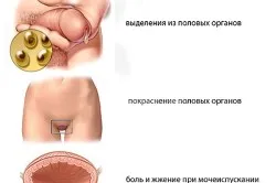 стоп ЗПСШ