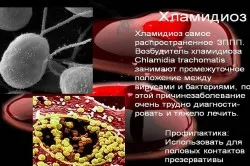як лікують хламідіоз у дітей