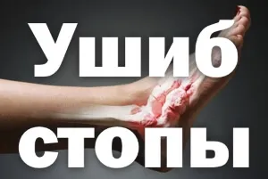 як швидко вилікувати забій стопи