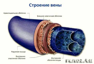 варикозне розширення вен симптоми