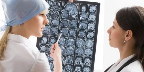 як вилікувати придбану епілепсію