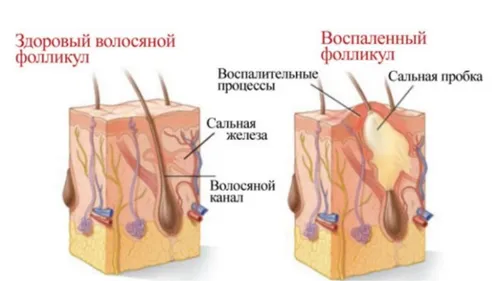 ніж лікувати випадання волосся у жінок