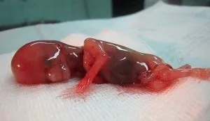 алкоголь вагітність час впливає плід розвиток наслідок спиртне фото початок