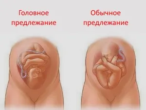 коли опускається живіт у вагітних