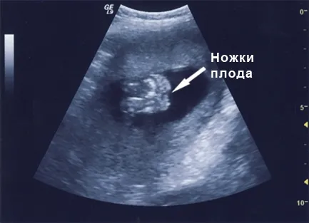 дитини