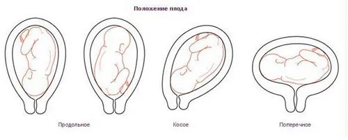 зростання матки при вагітності