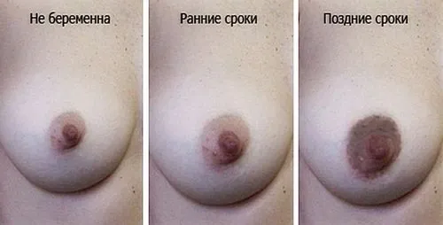 вид сосків під час вагітності