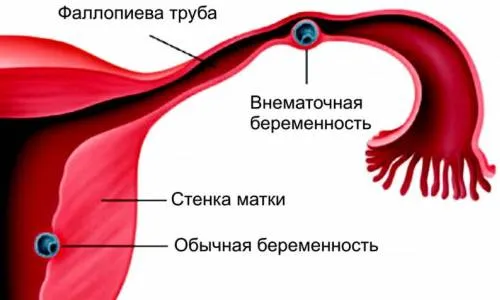 який термін вагітності показує узі