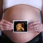 узі вагітних по тижнях, 3д узі вагітність тиждень фото 20 який термін 3д узі вагітність тиждень фото 20 який термін