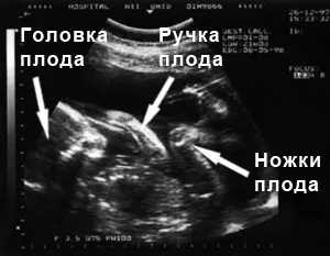 харчування вагітної жінки