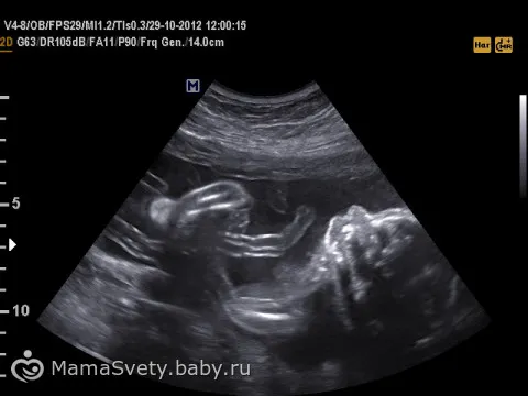 моєї