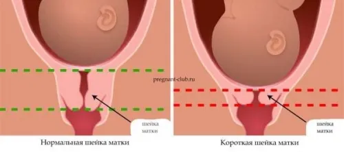 30 тиждень вагітності який це місяць