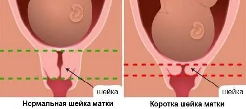 22 тиждень вагітності узі