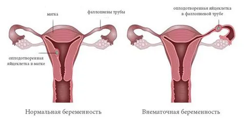базальна температура при вагітності до затримки