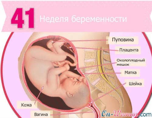 41 тиждень вагітності що робити