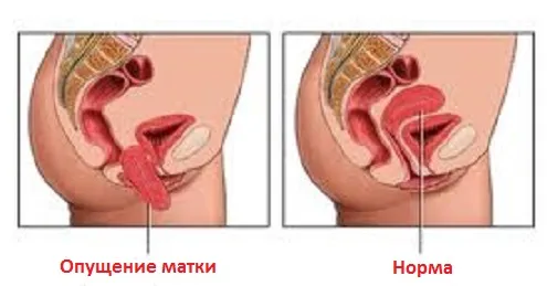 вагітність і статеве життя пози