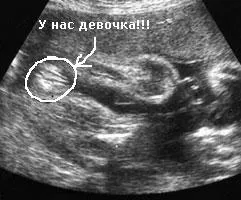21 тиждень вагітності хлопчик