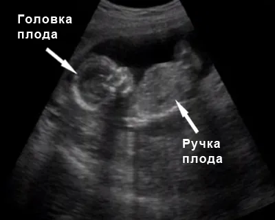 період