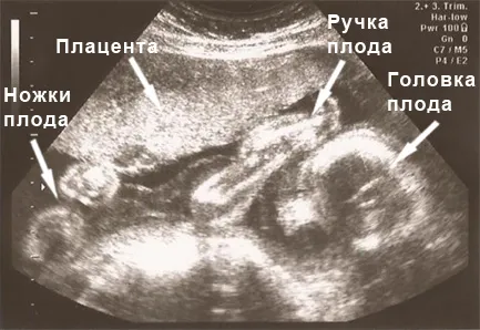 термін