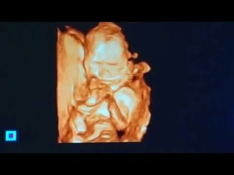 21 тиждень вагітності хлопчик