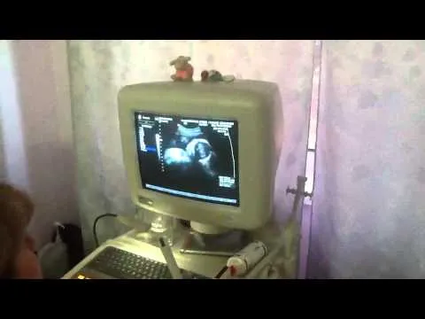 21 тиждень вагітності хлопчик