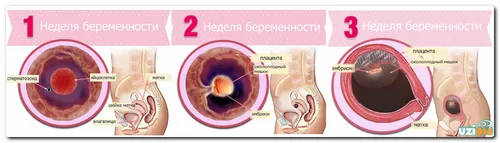 перші тижні вагітності узі