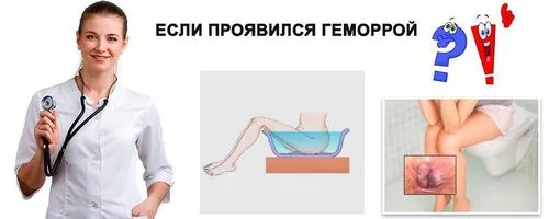 геморой у вагітних що робити
