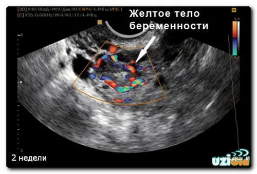 перші тижні вагітності узі
