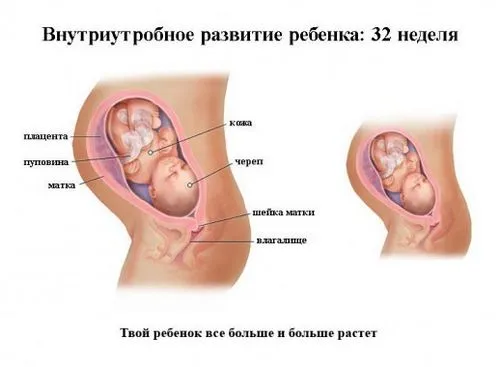узі на 32-му тижні вагітності