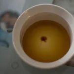 базальна