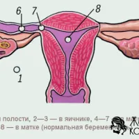 позаматкової