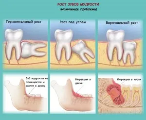 чи можна вагітній лікувати зуби
