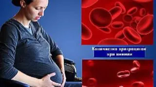анемія у вагітних лікування