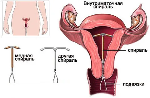 як не завагітніти після пологів