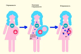 резус конфлікт при другій вагітності