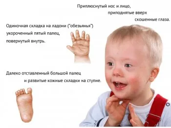 скринінг 1 триместру вагітності результат