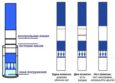 тест для визначення позаматкової вагітності