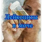 як позбутися від запорів під час вагітності