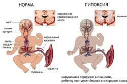 вагітність 5 місяців