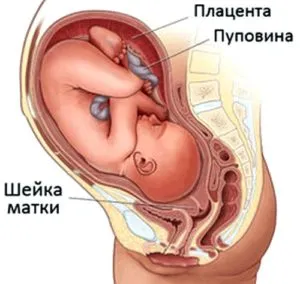 лікування ерозії шийки матки під час вагітності