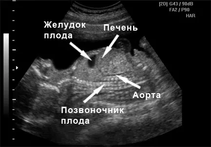 23 двадцять третій тиждень вагітність