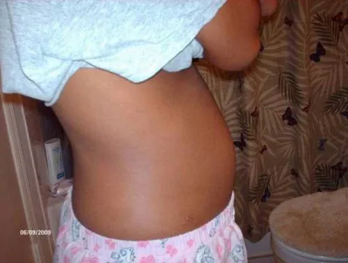 як виглядає плід на 12 тижні вагітності