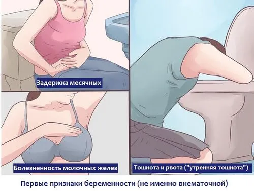 як визначити позаматкову вагітність