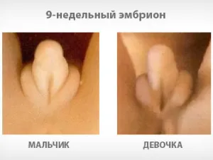 вагітність жінки