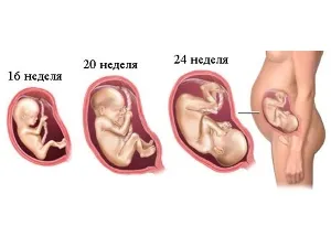 вагітність жінки