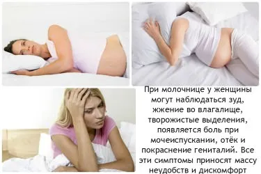 ніж шкідлива молочниця при вагітності
